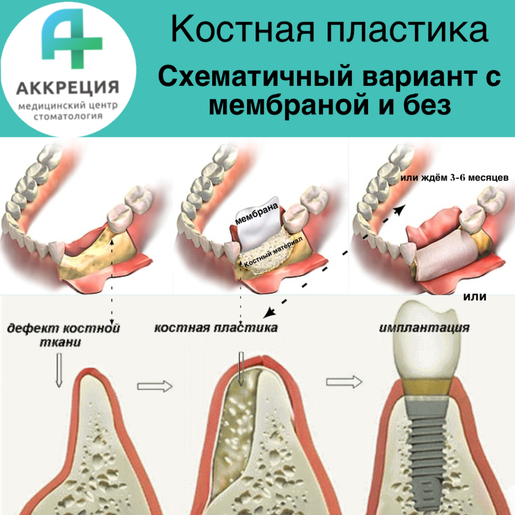 Костя пластиков