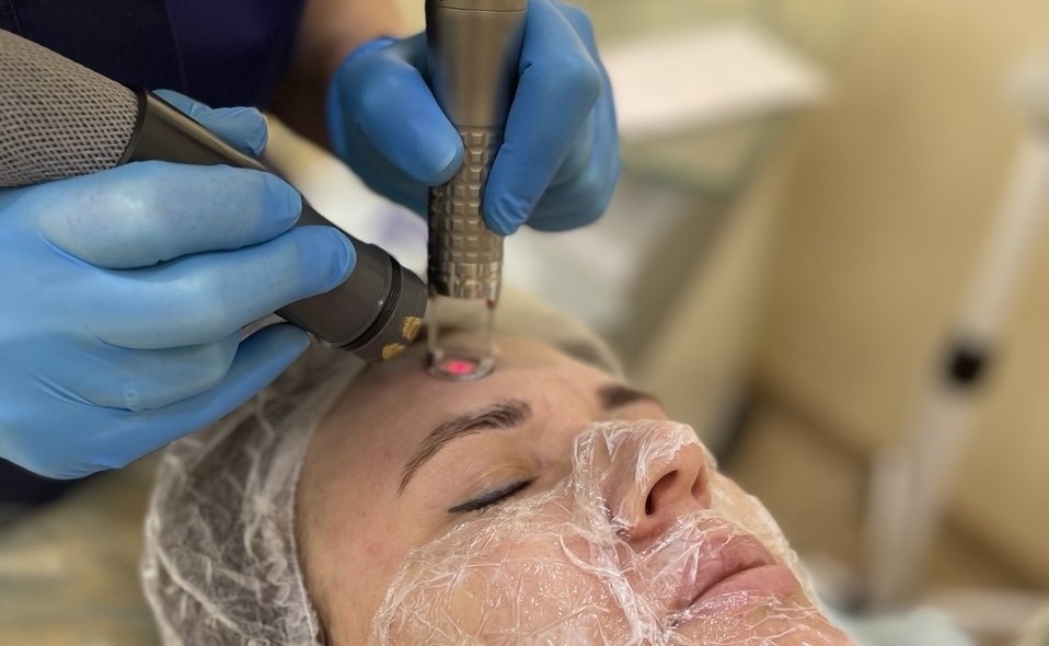 Уход после лазерного омоложения: как помочь коже восстановиться и сохранить результат надолго