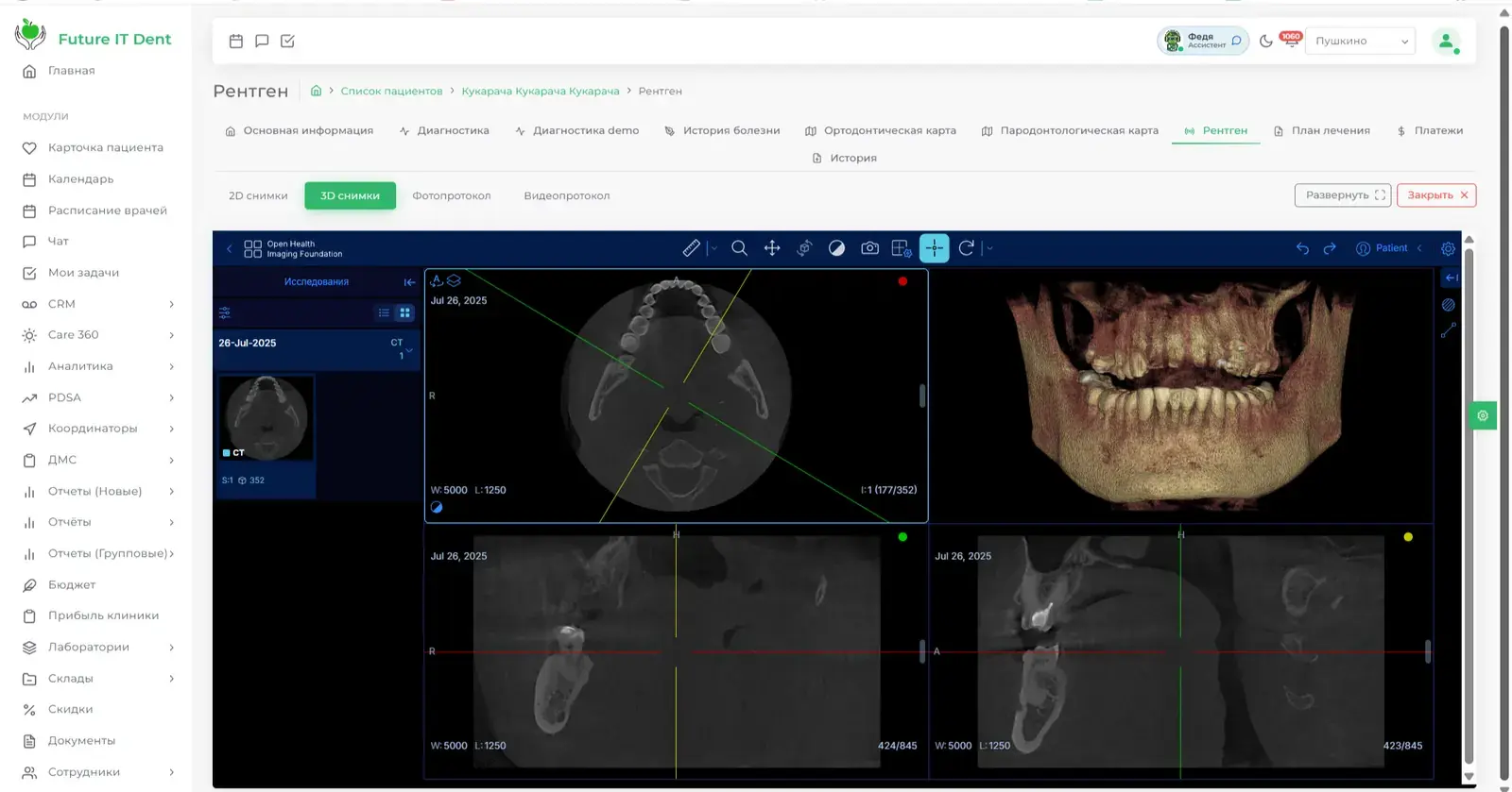 3D WebView и просмотр КЛКТ-исследования
