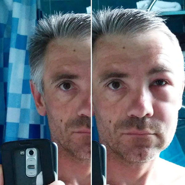 Пчелиный яд