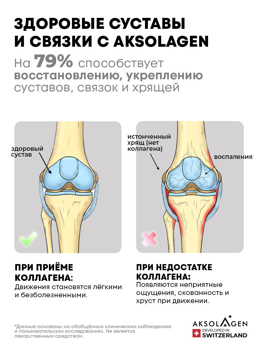Здоровые суставы и связки с AKSOLAGEN — при приёме коллагена