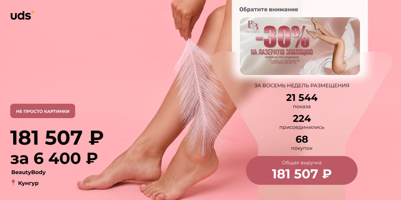 Реклама в UDS