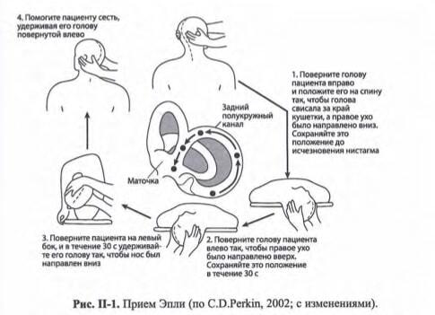 Тошнота, рвота, головокружение — какие могут быть причины?