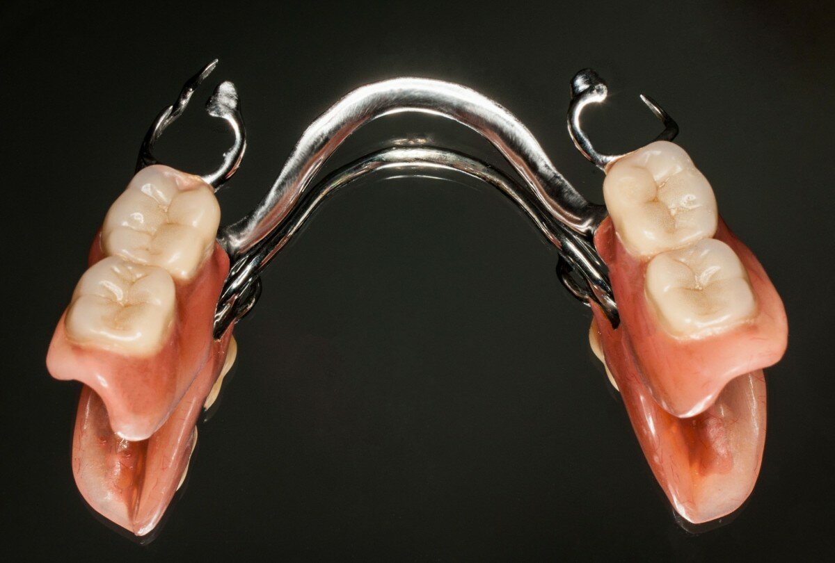 Съемные протезы зубов виды фото