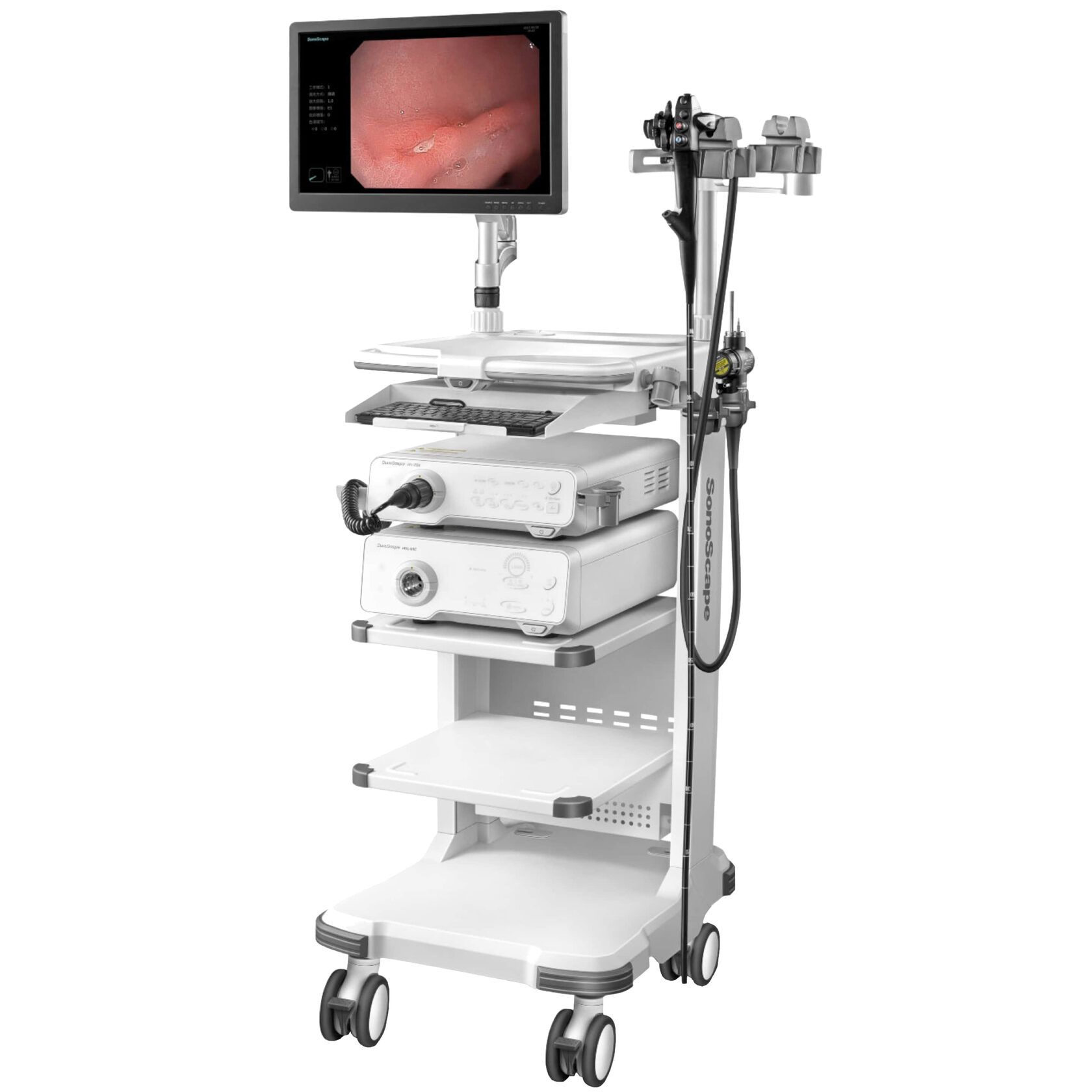 Видеоэндоскопическая система SonoScape HD-350S