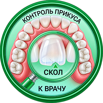 Уход за винирами после фиксации