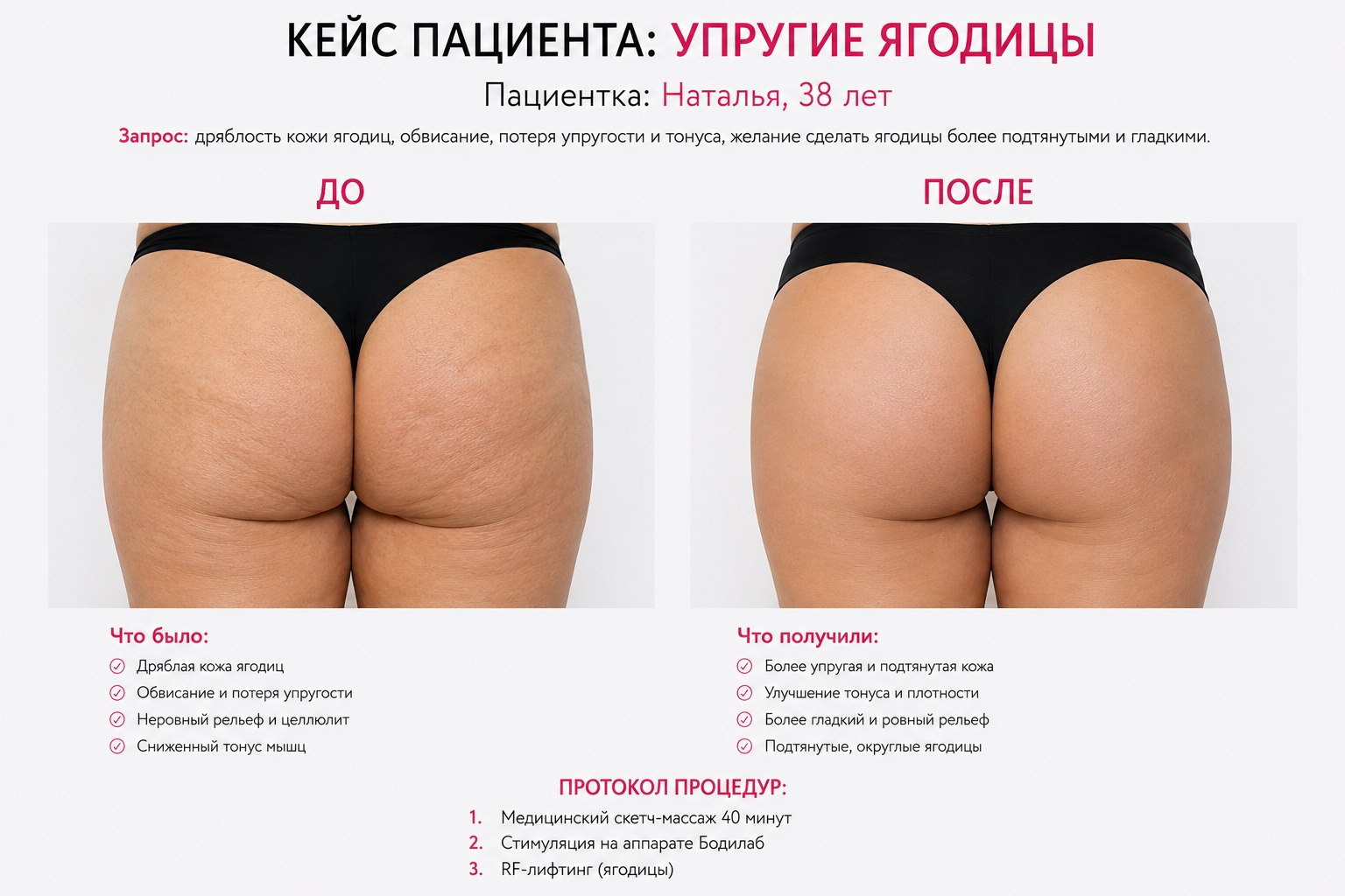 Кейс пациента до и после