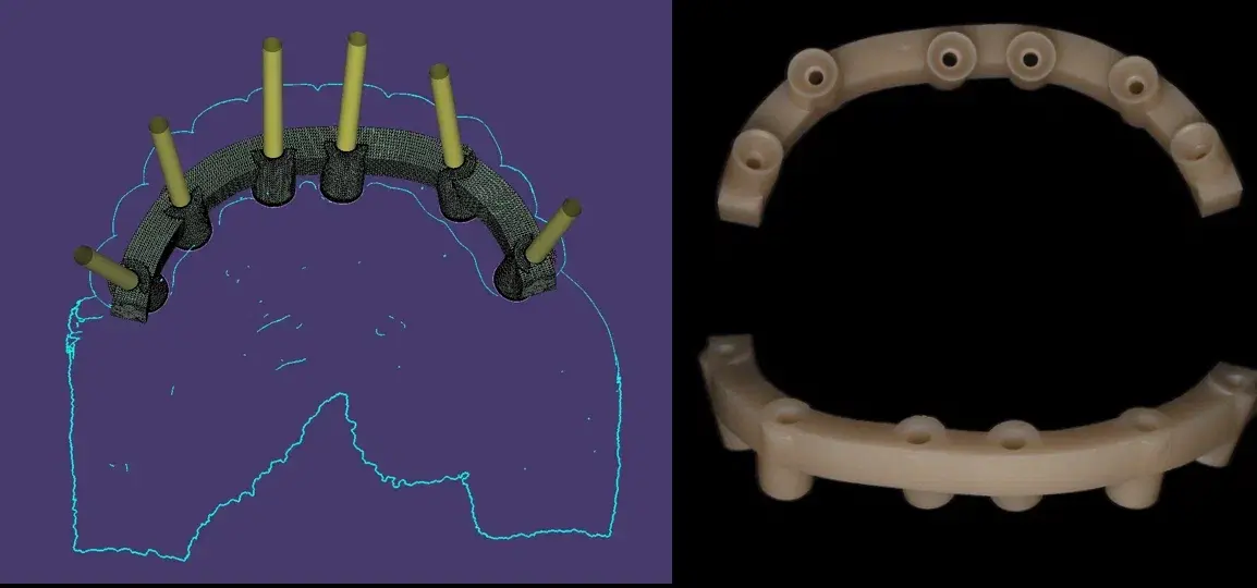 интраоральное сканирование