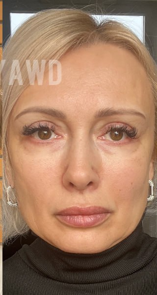 Елена после