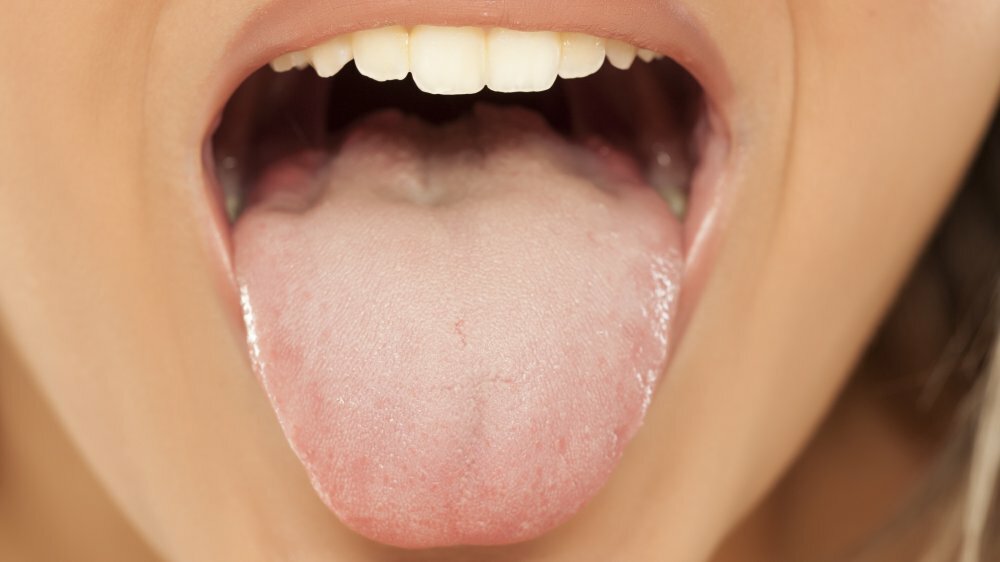 Белый язык и неприятный запах изо рта