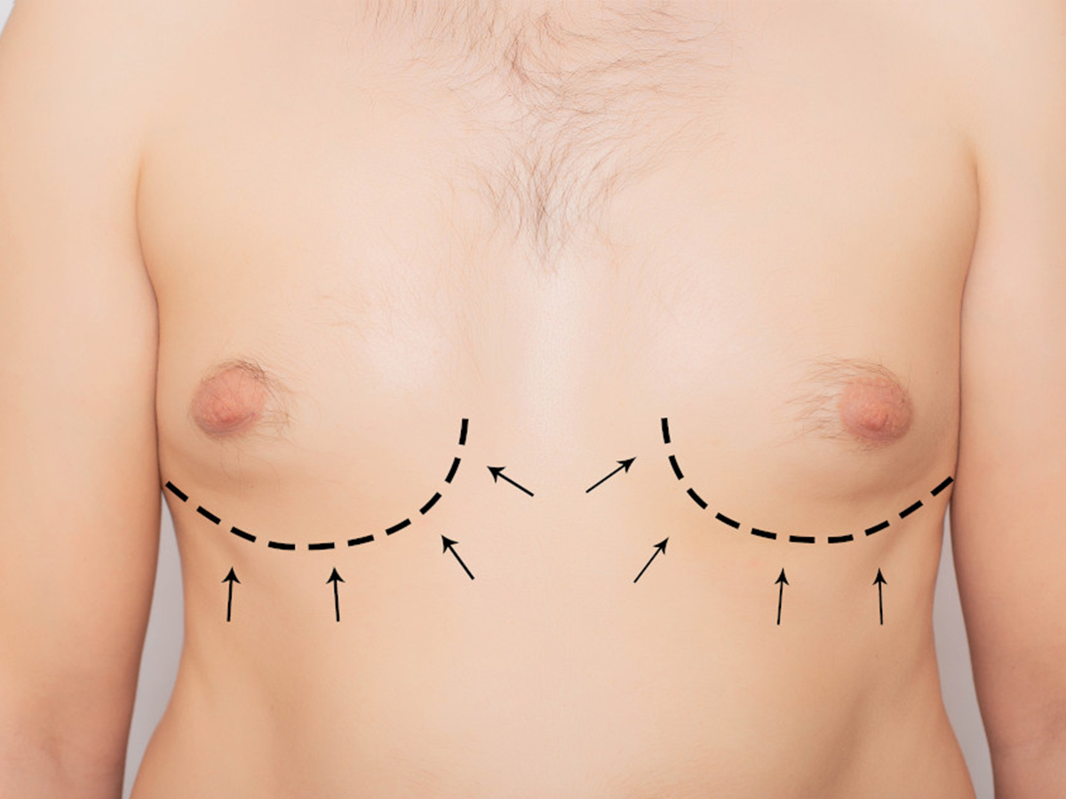 узлы на груди у женщин фото 67