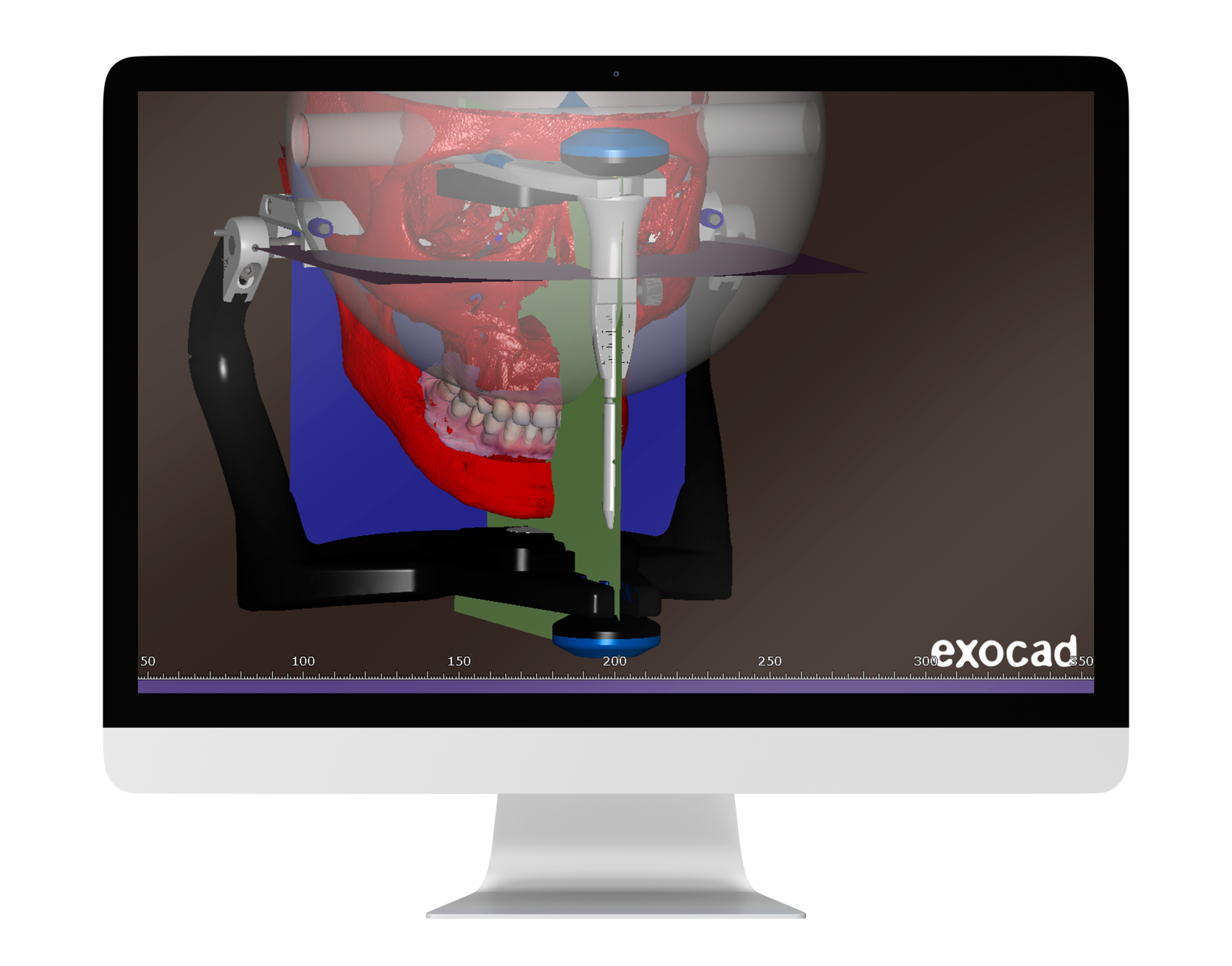 Онлайн обучение exocad