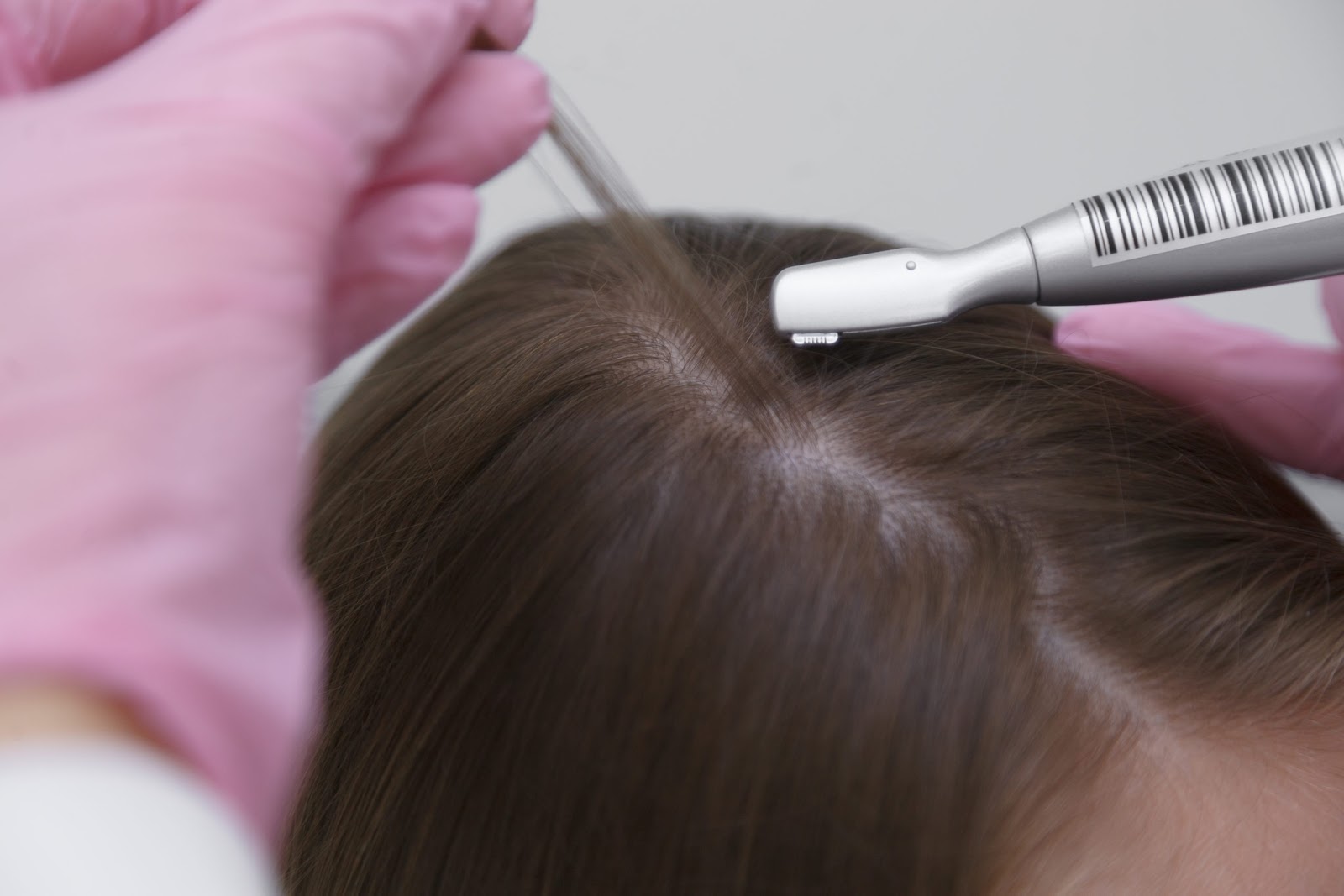 Диагностика волос