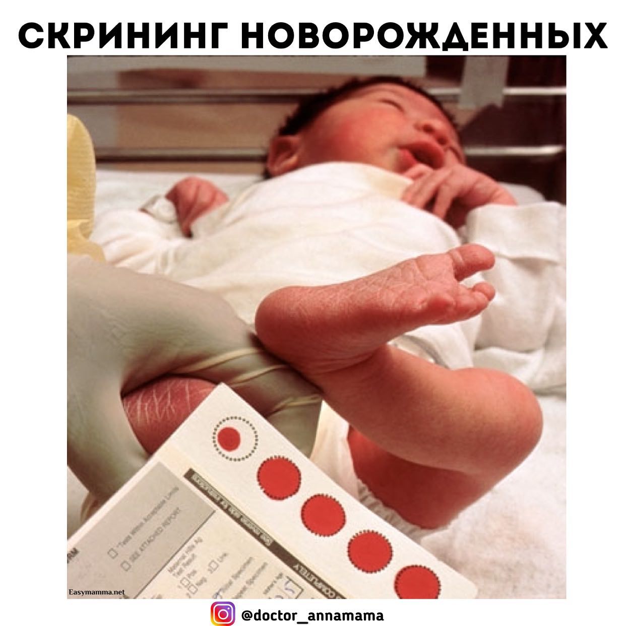 5 заболеваний новорожденных. Неонатальный скрининг новорожденного. Кровь на неонатальный скрининг новорожденных. Пять заболеваний скрининга новорожденного. Галактоземия неонатальный скрининг.