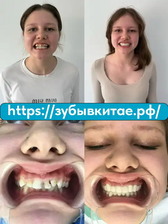 До и после — кейс 16