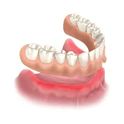 имплантация зубов, имплантация зубов Голицыно, стоматология в Голицыно, имплантация зубов цена, имплантация зубов под ключ, имплантация зубов под ключ цена, имплантация зубов МСК, имплантация Москва, зубной имплант Голицыно, установка импланта, зубное протезирование.
