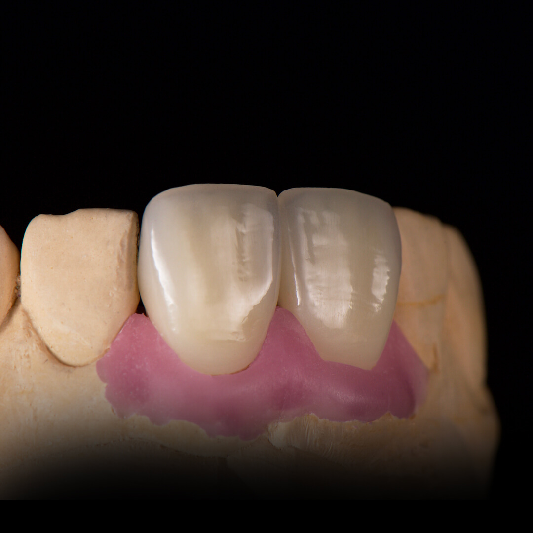 Зуботехническая лаборатория москва