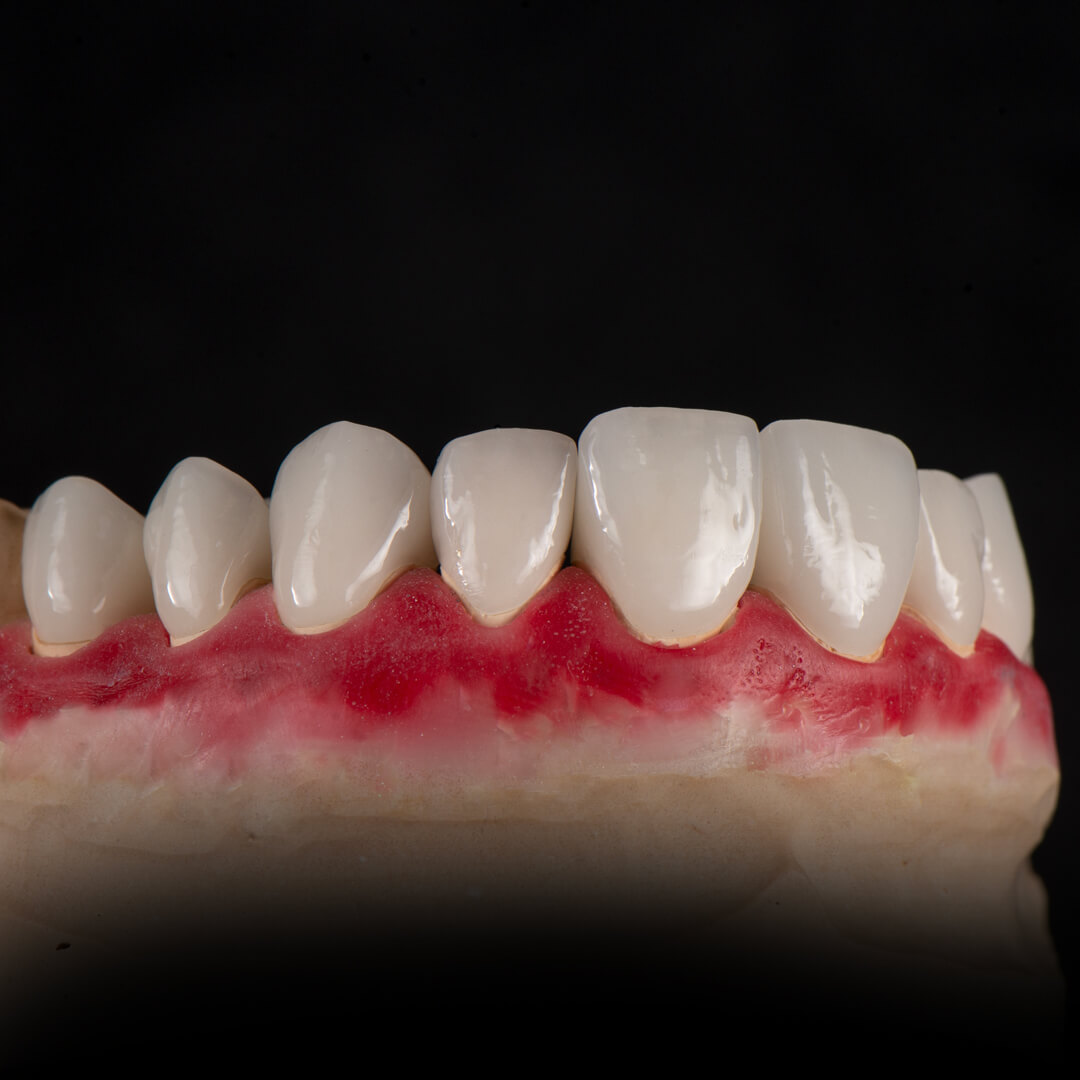 Зуботехническая лаборатория москва