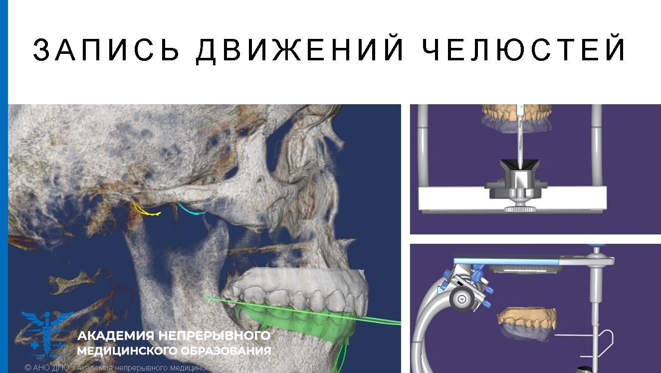 Cad cam технологии в ортопедической стоматологии презентация