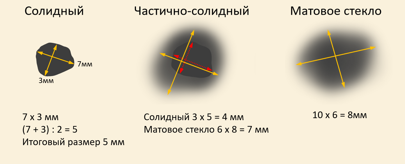 Методика измерения очага в лёгком на КТ