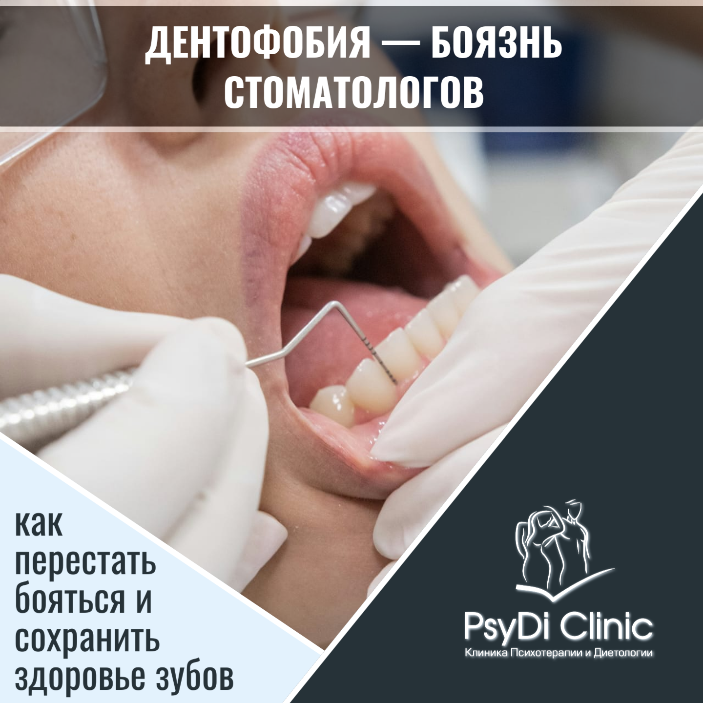 Дентофобия — боязнь стоматологов: как перестать бояться и сохранить здоровье зубов ��