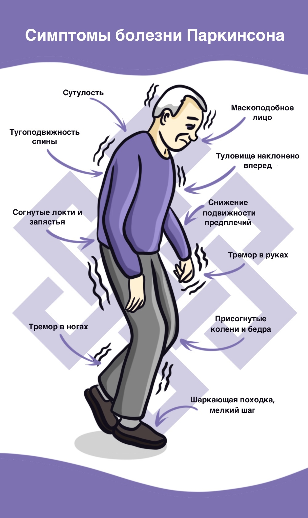 Болезнь Паркинсона | Лечение болезни Паркинсона в Москве | Клиника НАКФФ в Москве