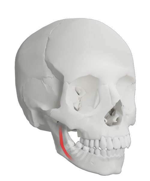 сложное удаление зуба мудрости