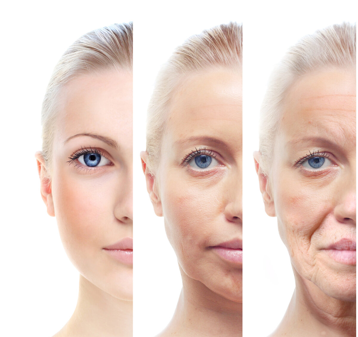 Signos del envejecimiento de la piel