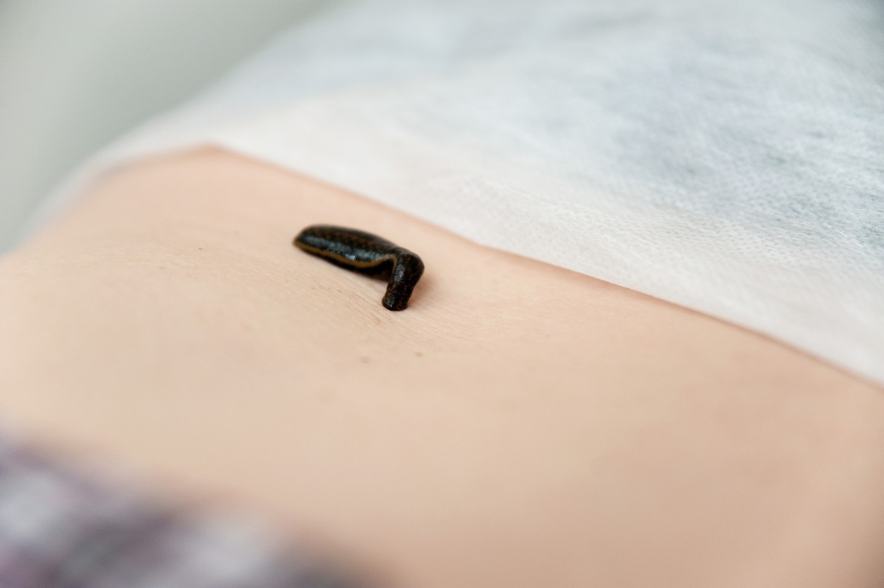 Экстракты и гидролизаты медицинских пиявок