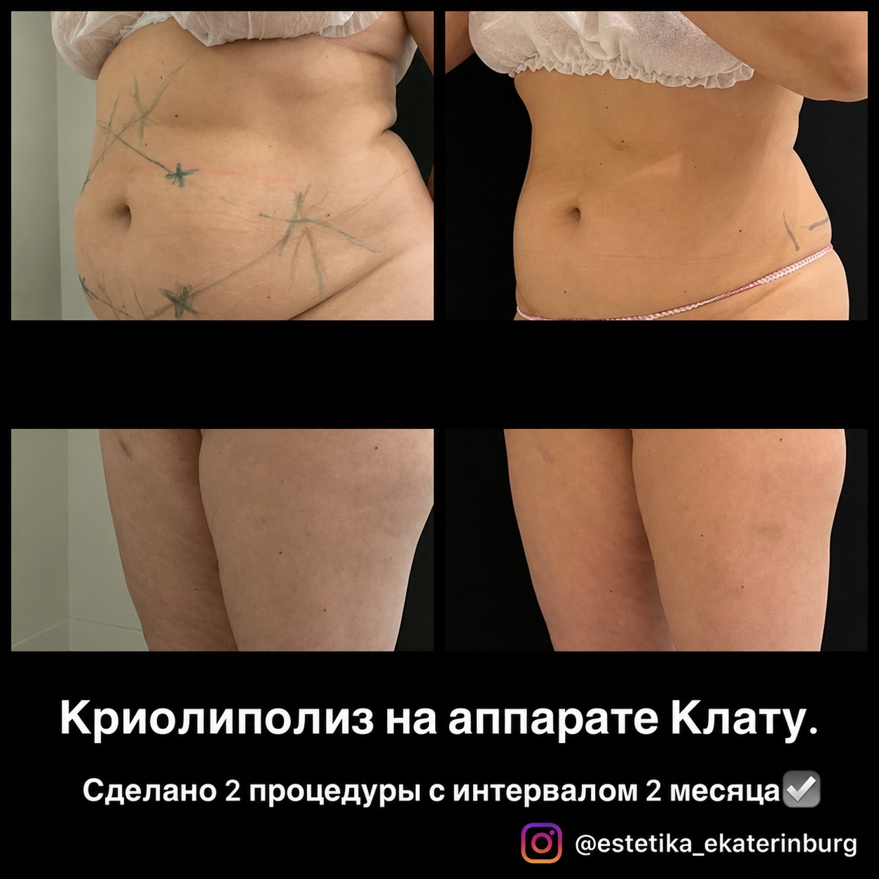 Пример результата Clatuu