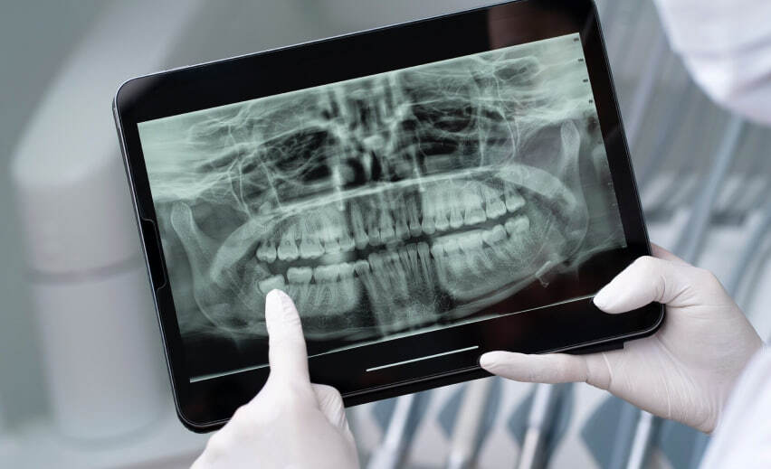 профессиональная гигиена полости рта