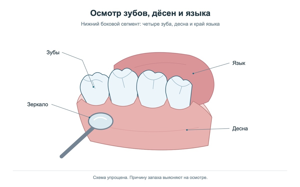 Осмотр полости рта: зеркало у десны, зубы и язык