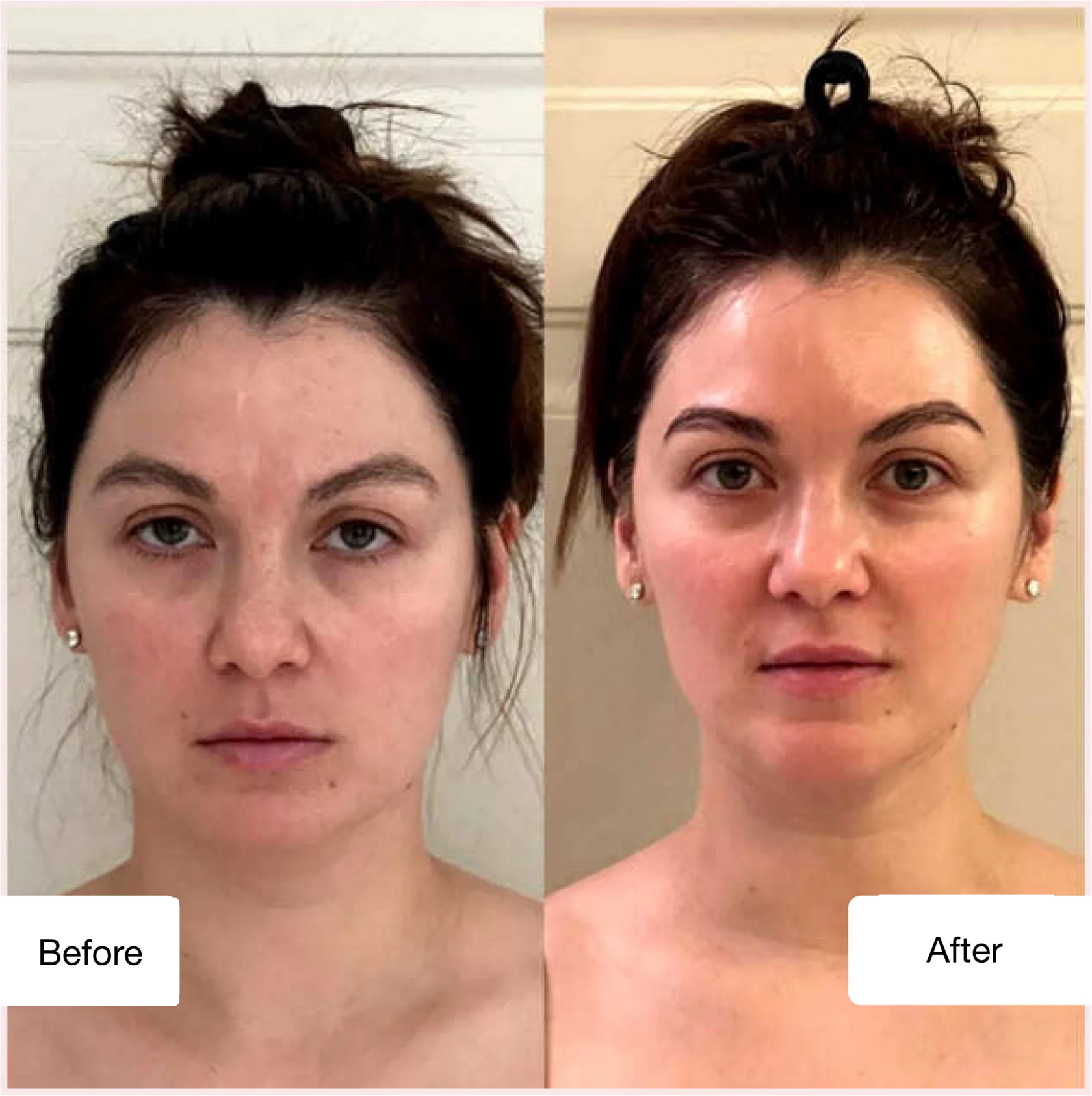 Before and after