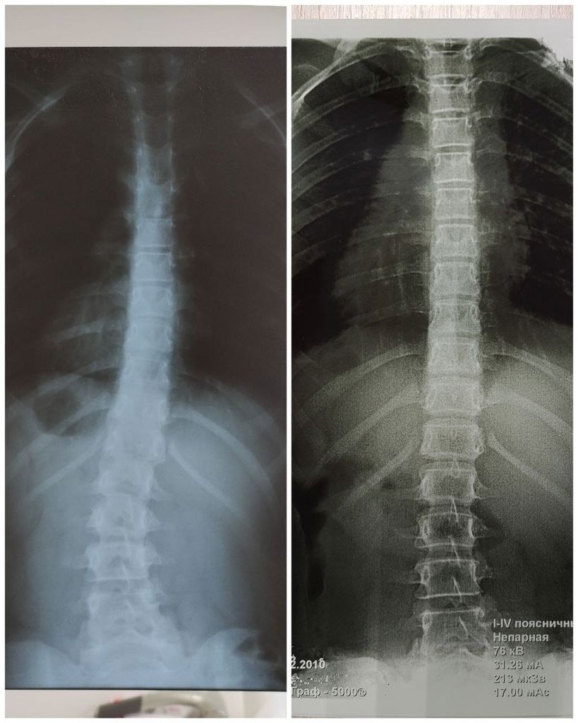 Фото пациента