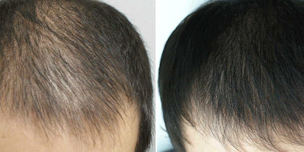 Как восстановиться после родов волосы и кожа