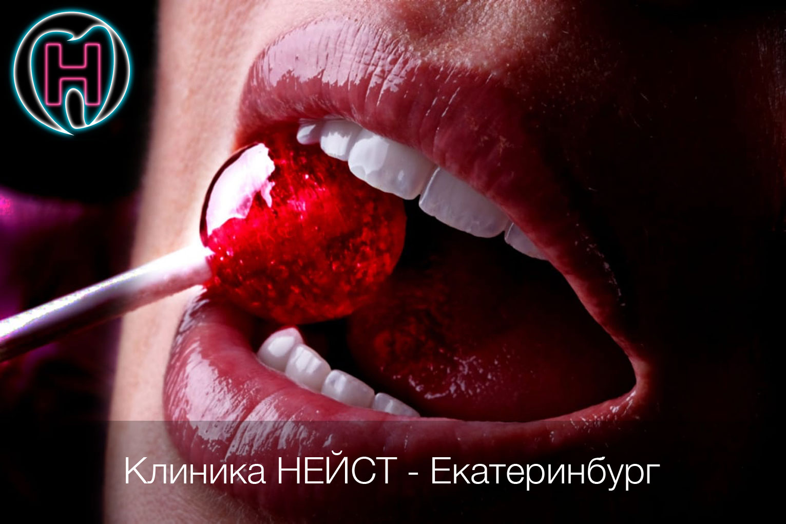 Лучшие керамические виниры в Екатеринбурге