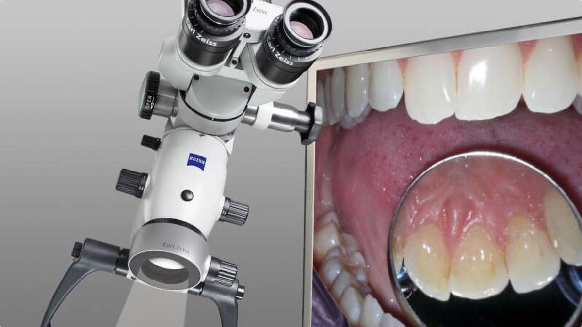 Микроскоп зуба. Микроскоп эндодонтия. Микроскоп в стоматологии. Стоматология под микроскопом. Эндодонтический микроскоп в стоматологии.