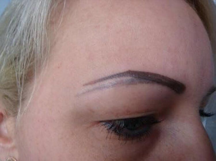 перекрытие татуажа, неудачное перекрытие татуажа