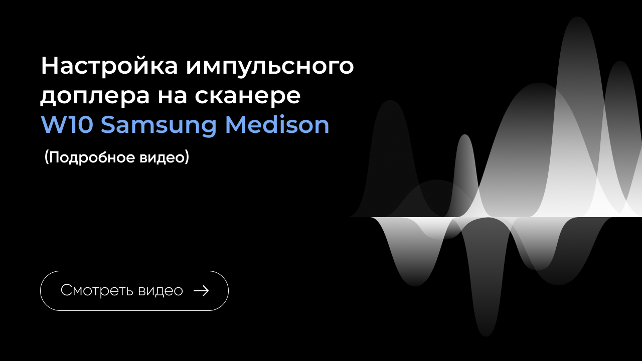 Настройка импульсного доплера на Samsung W10