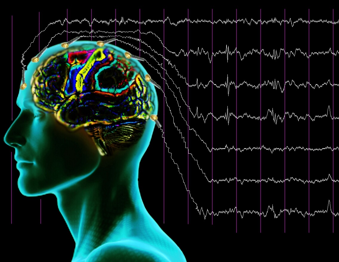 Электроэнцефалограмма головного мозга 15 минут