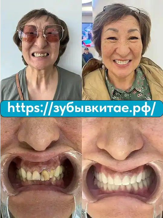 До и после — кейс 3