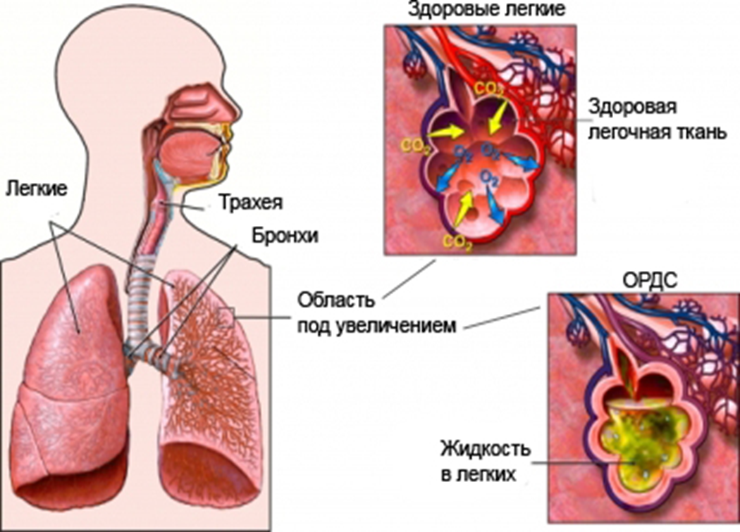 Симптомы заболеваний лёгких