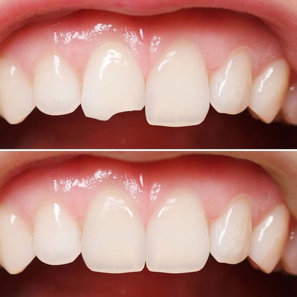 работы стоматологов фото до и после