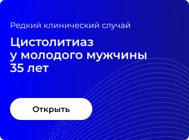 ЦИСТОЛИТИАЗ У МОЛОДОГО МУЖЧИНЫ 35 ЛЕТ