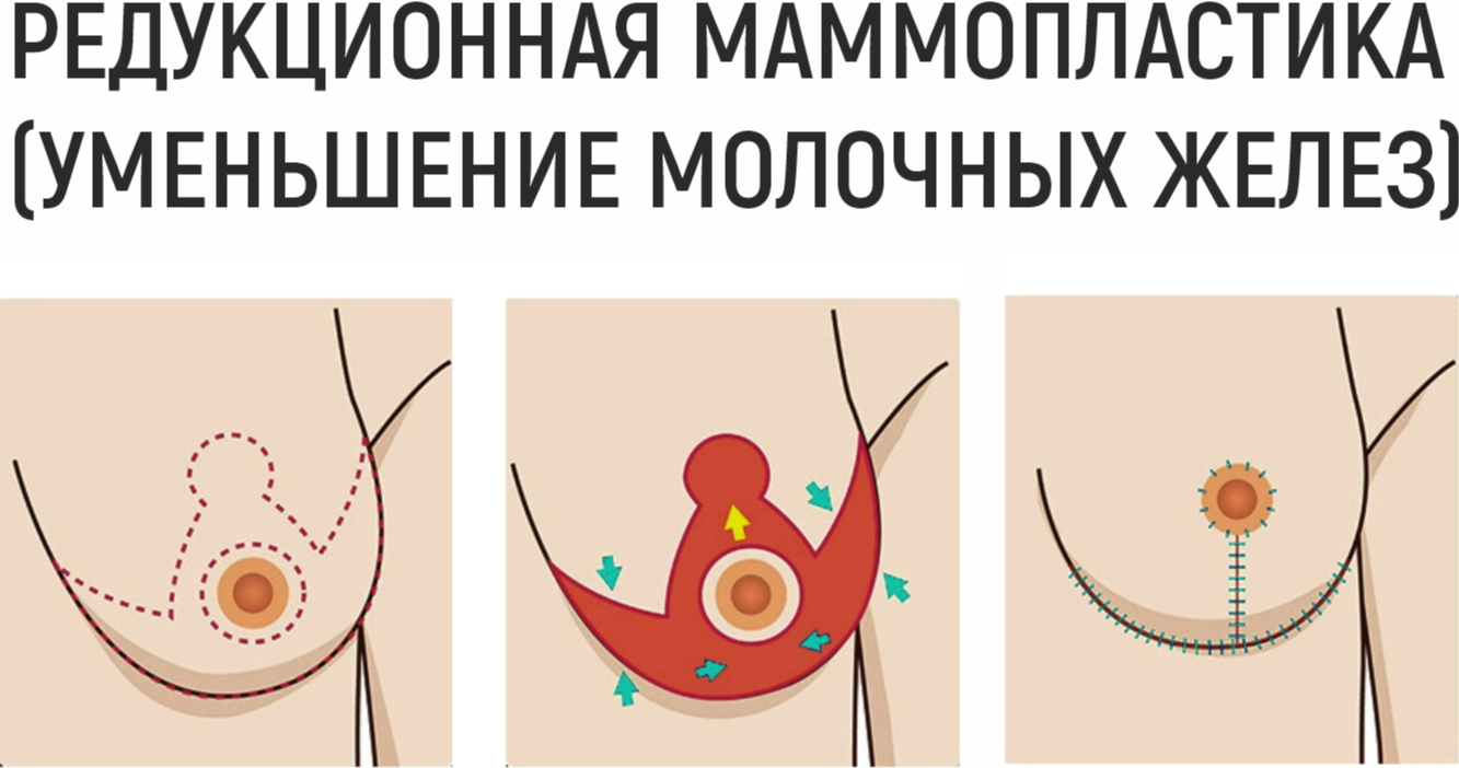 Сексуальная девушка режет платье палит грудь и попу на стриме - Yandex Video aramada çevrimiçi izle Сексуальная девушка режет платье палит грудь и попу на стриме - Yandex Video aramada çevrimiçi izle