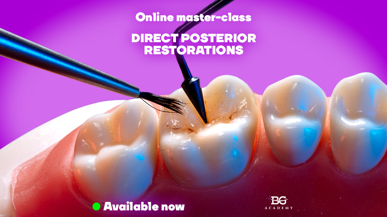 Figure 29 From Direct Posterior Composite Restoration vrogue.co