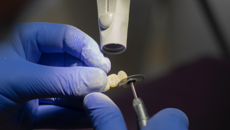 Изготовление временных коронок — виды и цены в Дербенте. Стоматология DK