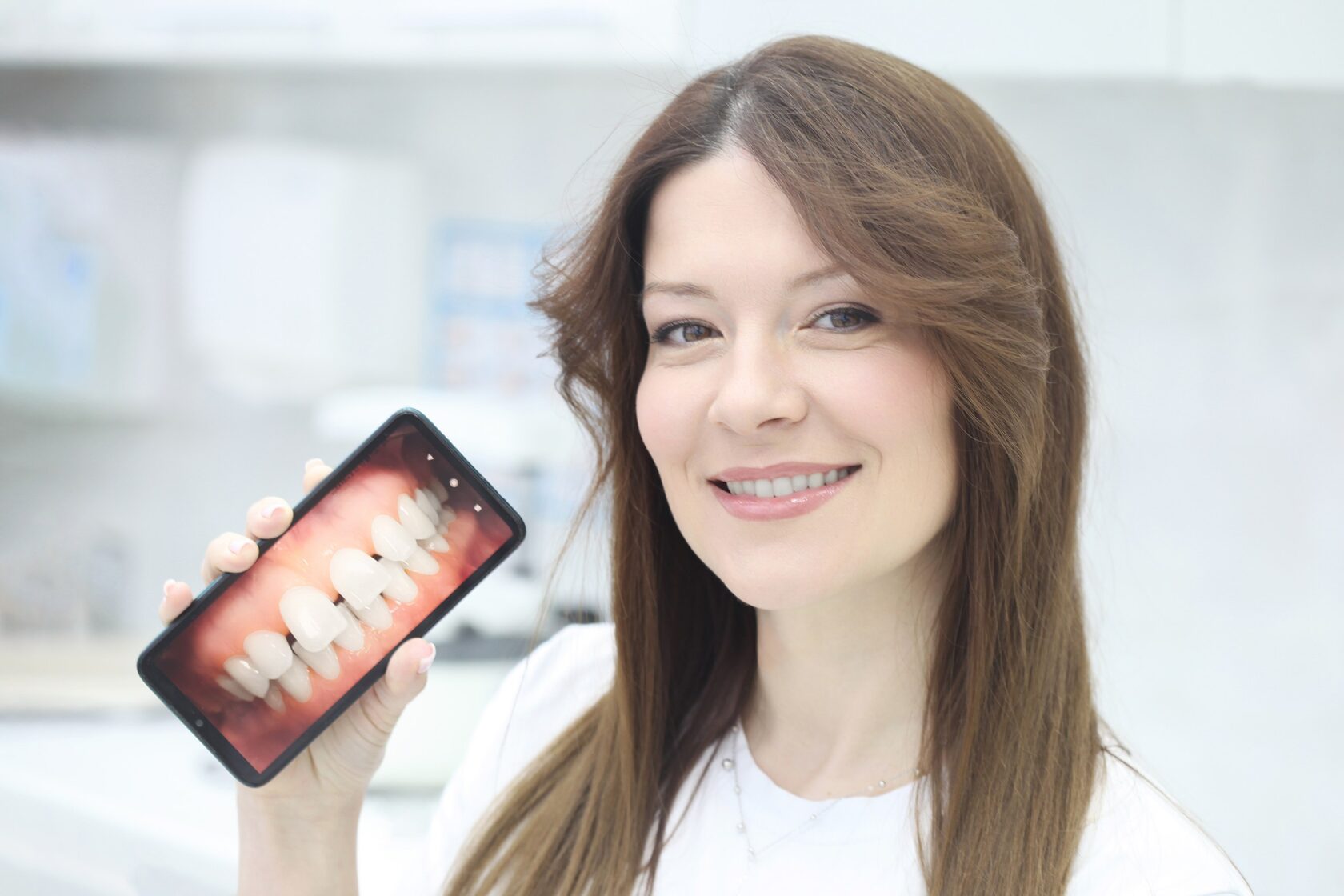 Установка виниров во Владимире