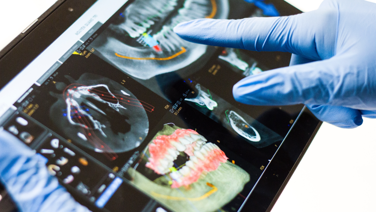 Функциональная диагностика ВНЧС: цены в Дербенте. Стоматология DK