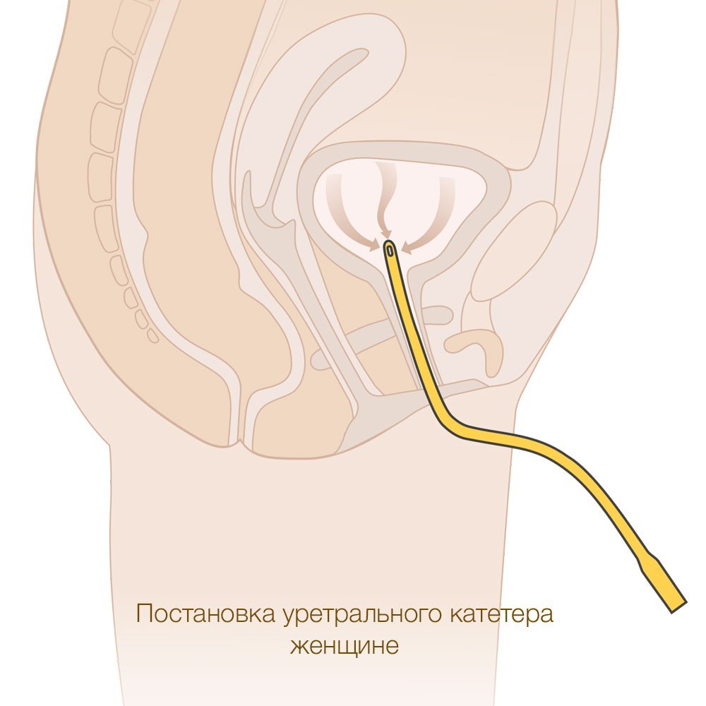 силиконовые урологические презервативы. mederen